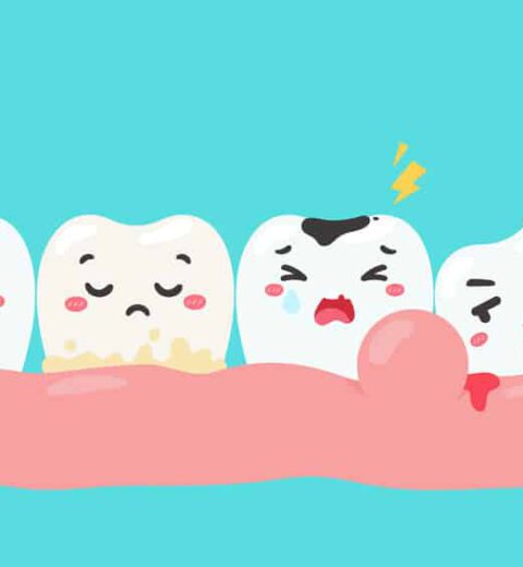 Chảy máu chân răng là gì? Nguyên nhân và cách phòng ngừa