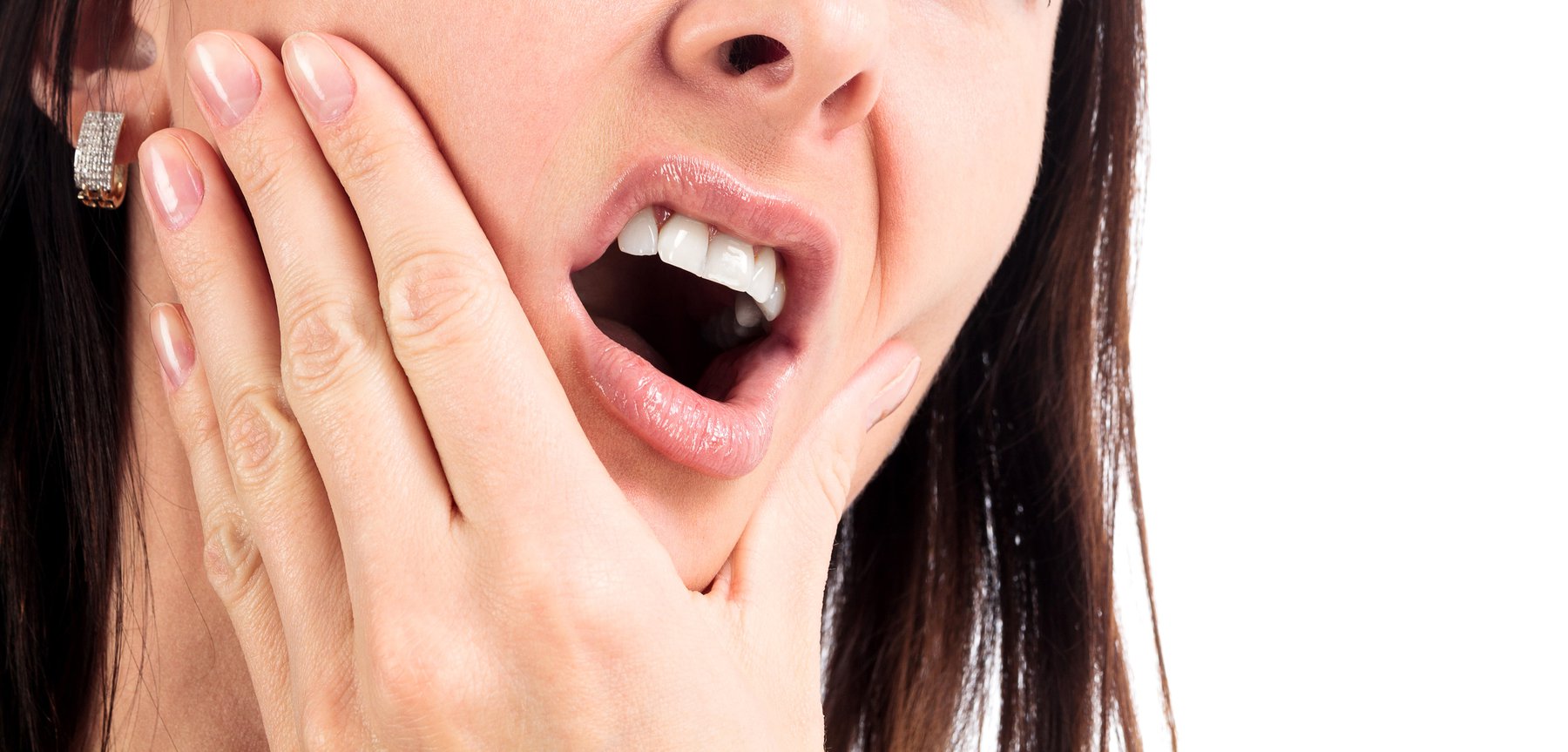 Mòn cổ răng - bệnh lý nha khoa phổ biến nhưng dễ bị bỏ qua