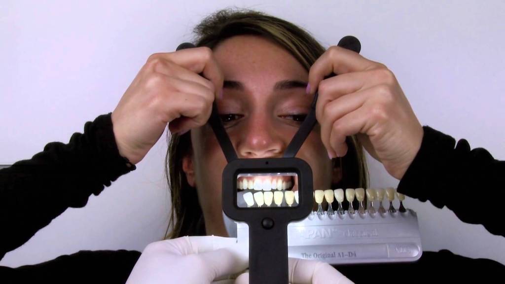 Thủ thuật lâm sàng và một số lưu ý để so màu răng tốt hơn