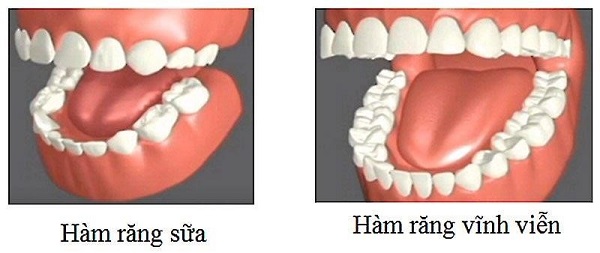 Răng Hàm Có Thay Không Và Cách Bảo Vệ Răng Chắc Khỏe Bạn Cần Biết