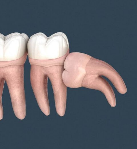 Thủ thuật lâm sàng và một số lưu ý để so màu răng tốt hơn